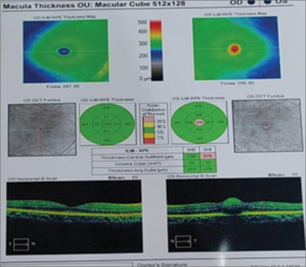 Optical coherence tomography after 10 weeks of treatment.